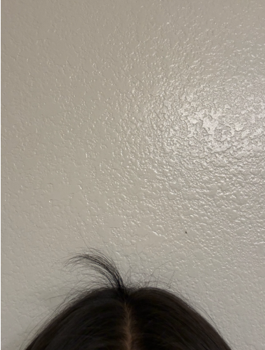 After photo of a patient hair transformation