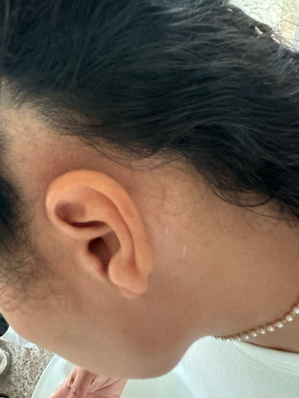 Before photo of a patient hair transformation
